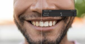 Capture One 16.7 Teeth Whitening